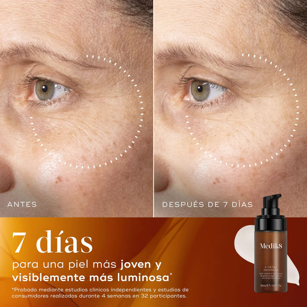 C-Tetra® Advanced