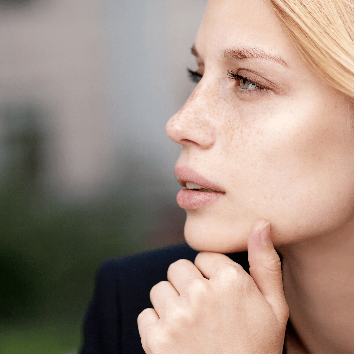 Hyperpigmentation: everything you need to know